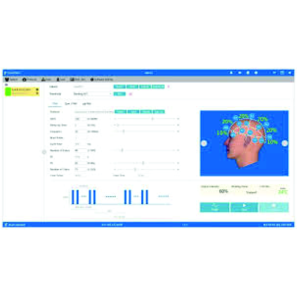 EMT TMS rTMS TMS Estim Magnético Transcraneal